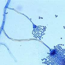Aspergillus Genere di funghi imperfetti.