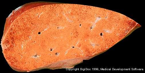 Tra le micotossicosi naturali causate dalle aflatossine: aflatossicosi (Malattia X del