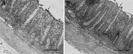 Intestinal epithelium cells of pigs after infection with pathogenic Escherichia coli bacteria : left =