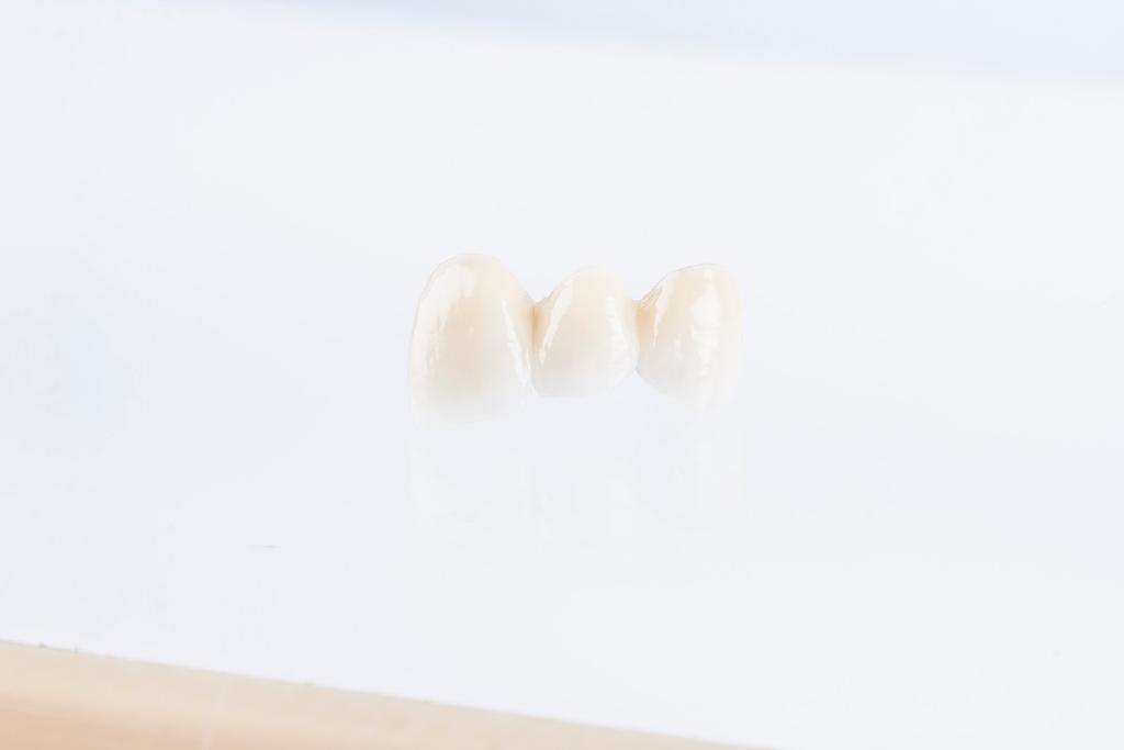Tonalità più luminose - grigio eliminato con solo due masse Taglio della dentina per l incisale Prima di enliven, la tecnologia di pigmentazione utilizzata nella metallo ceramica era la stessa