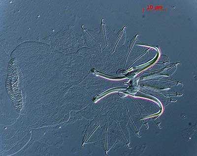 causata da un ectoparassita trematode monogeneo, Gyrodactylus salaris, che ha determinato