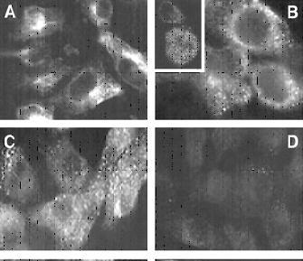 Direct effect of plasma permeability factors