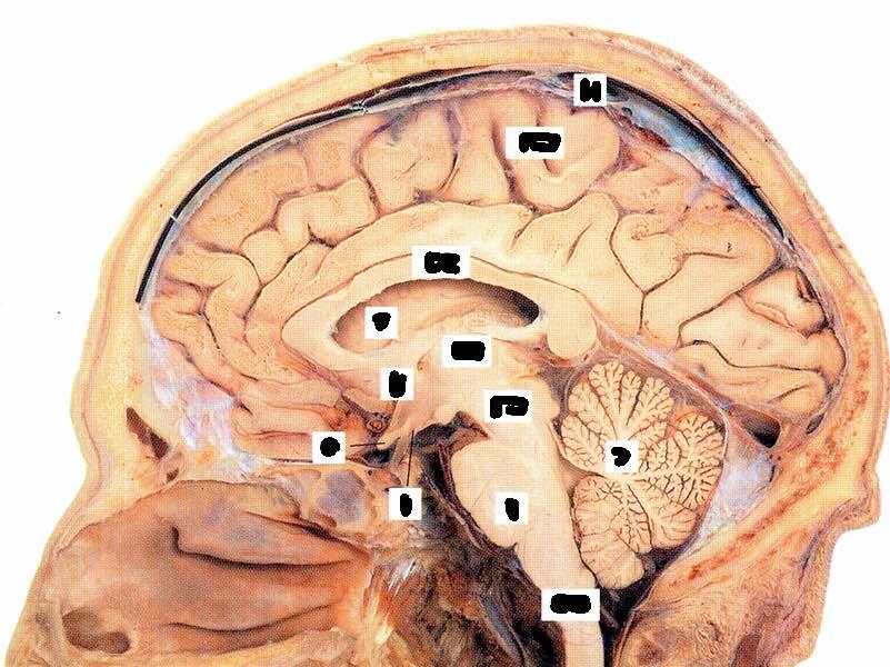 M EC CC V IP TA ME O C PI P MA M=meningi, EC=emisfero cerebrale, CC=corpo calloso, V=ventricolo laterale, TA=talamo, IP=ipotalamo,O=nervo ottico, PI=peduncolo