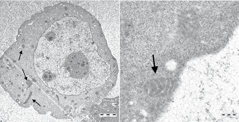 (frecce) (6000X). B: i mitocondri localizzati nel citoplasma contenevano quantità variabili di micelle di ferro tra lamelle e creste (freccia) (8700X). Figura 2.
