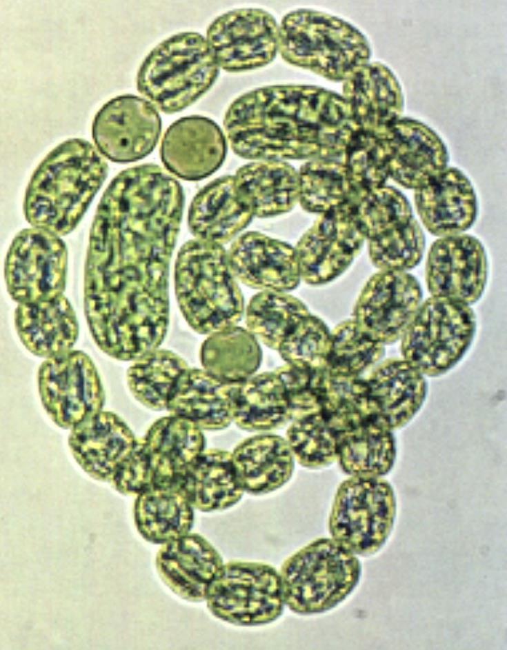 eterocisti (enzima nitrogenasi)