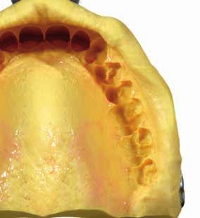 Orthoprint Alginato per l ortodonzia Sistemi per l impronta / Impronta preliminare Orthoprint è un alginato specifico per l uso ortodontico che coniuga precisione e praticità.