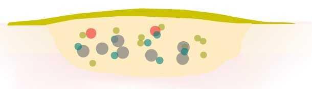 Normale ferita acuta Livelli inferiori di citochine proinffiamatorie Maggior numero di fattori di crescita Aumento della mitosi cellulare (le cellule sono in grado di rispondere rapidamente) Livelli