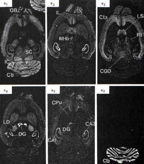 LA E IL CERVELLO PSICOFARMACOLOGIA DELLA GENI, CRESCITA NERVOSA E LA REGOLAZIONE DELL ATTIVITÀ DEI GENI localizzazione dei recettori per il GABA nel cervello di ratto Risonanza magnetica funzionale