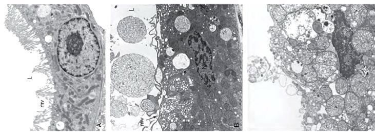 blebs scomparsa microvilli degenerazione idropica CELLULA EPITELIALE NORMALE