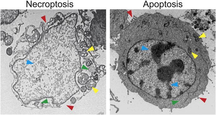 Necroptosi La necroptosis è un tipo di morte cellulare programmata regolata dalle proteine Receptor-Interacting Protein 1 (RIP1), RIP3 e Mixed Lineage Kinase Domain- Like (MLKL) proteina.