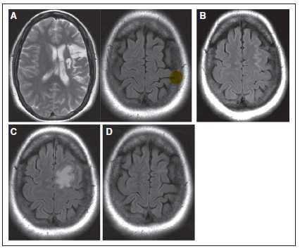 dose-dipendente 4) Outcome