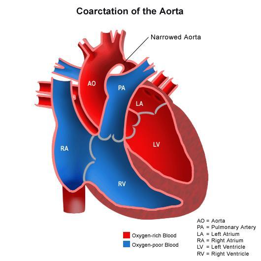I Grandi Vasi Sanguigni Il ventricolo sinistro pompa il sangue dal cuore nell aorta passando attraverso la valvola