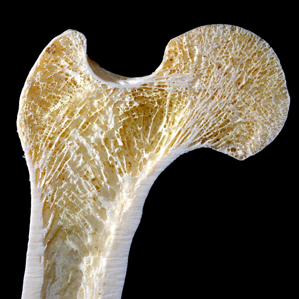 Struttura dell osso In base alla sua struttura macroscopica l osso l si
