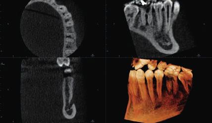 diagnostiche altamente dettagliate zate con una dose ridotta di radiazioni.