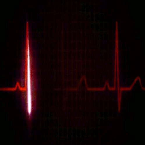 dilatazione delle camere cardiache, infarto del miocardio, angina,