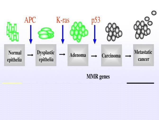 paradigm of translational oncology there are very few neoplasms in which research has been translated