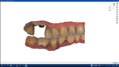 Figura 3: File Trios Color riportato sul software CAD