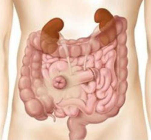 5 di 6 L ileostomia è un apertura creata chirurgicamente, attraverso la quale il tratto finale dell intestino tenue viene fatto fuoriuscire sulla superficie dell addome.