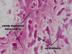 OSTEOINDUZIONE (FORMAZIONE DI