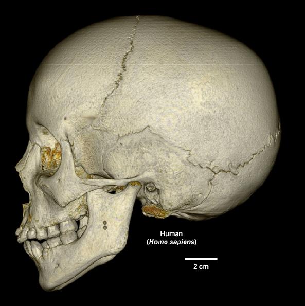 STIMA DELL ETÀ DI MORTE Adulti Mentre negli individui subadulti i parametri sono numerosi e precisi, negli adulti i processi di accrescimento sono terminati; per stimare l età di morte di un