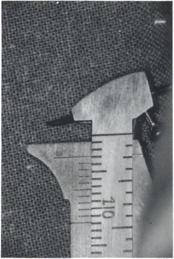 L altezza delle linee segnate sulle superfici vestibolari dei denti serve per posizionare i brackets