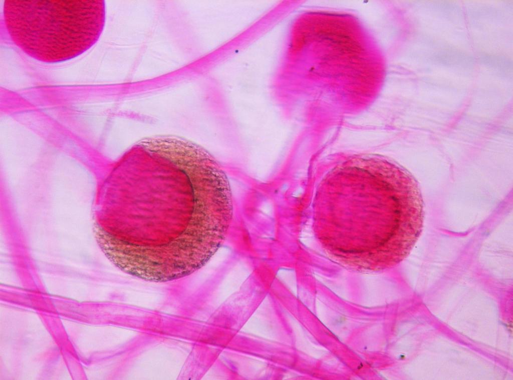 Rhizopus: ife sporangiofore e sporangi con endospore R. F. Ev