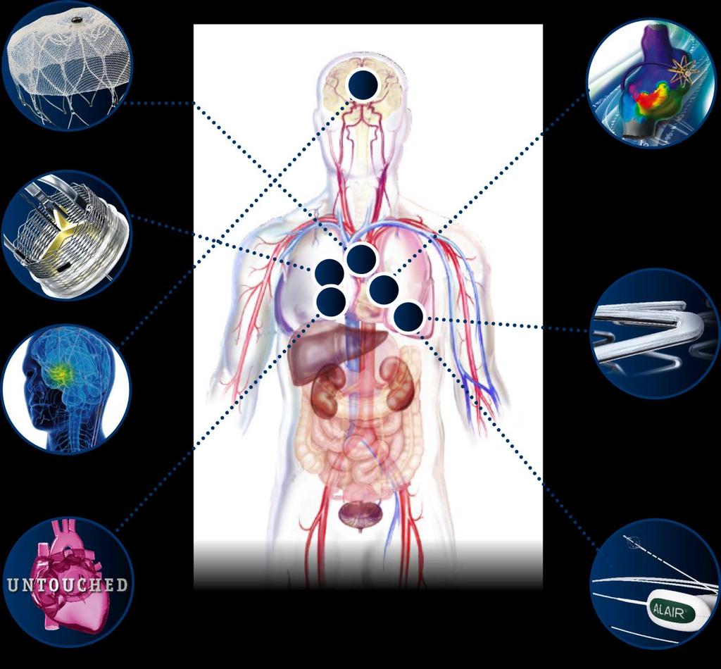 Innovazioni che cambiano l approccio terapeutico Dispositivo WATCHMAN per la chiusura dell appendice atriale sinistra (LAA) Soluzione non farmacologica per