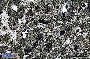 TESSUTO OSSEO. È formato da cellule dette osteociti, isolate ed immerse nella sostanza intercellulare detta osseina, robusta e calcificata.