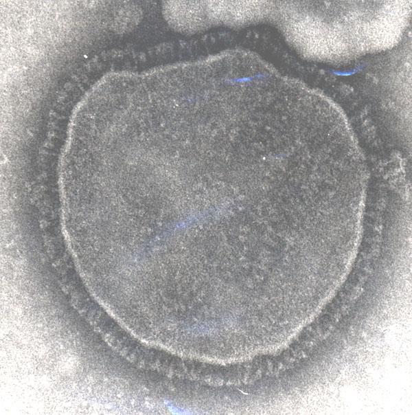 Virus del Morbillo Il Morbillo è un infezione sistemica causata da un virus, specificamente un Paramyxovirus del genere Morbillivirus.