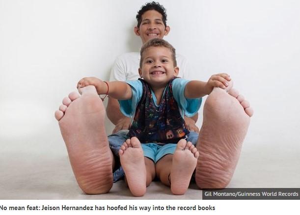 I piedi più lunghi del mondo sono del venezuelano sig.