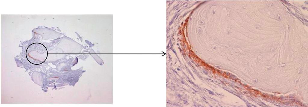 Fig. 11 ALP T0: immagine a ingrandimento totale 40x e suo particolare a ingrandimento 400x, colorazione immunoistochimica con anticorpi anti ALP, controcolorazione con ematossilina di Mayer.