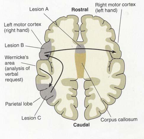 SUBSTRATI ANATOMOFUNZIONALI DEL MOVIMENTO VOLONTARIO Circuiti parieto-frontali: integrazione sensorimotoria in reaching e grasping Sistemi