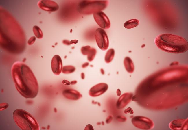 ANEMIA DA CARENZA MARZIALE SINTOMI Astenia Dispnea da sforzo Cefalea Cardiopalmo Insonnia