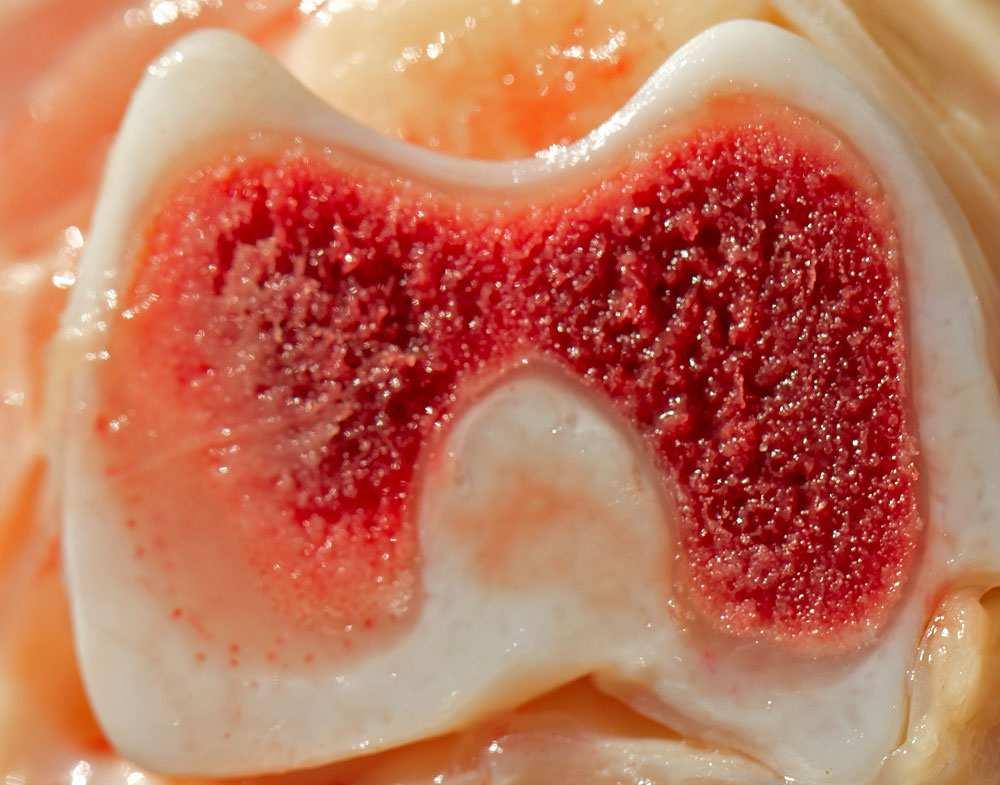 Osso spugnoso di una epifisi: Midollo rosso dove nascono le cellule del sangue OSTEOGENESI La formazione di ossa durante lo sviluppo embrionale si