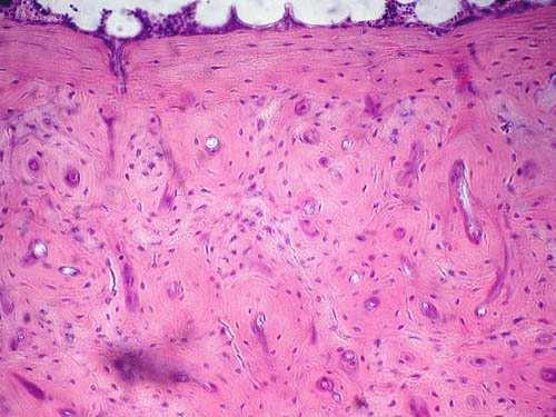 Una sottile fettina di osso vista al microscopio: le frecce indicano le cellule.