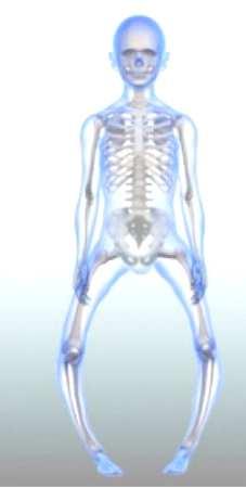 VITAMINA D e RACHITISMO La sostanza dura dell osso è formata in gran parte da sali minerali di calcio. Per questo motivo per la formazione dell osso è necessaria una grande quantità di calcio.