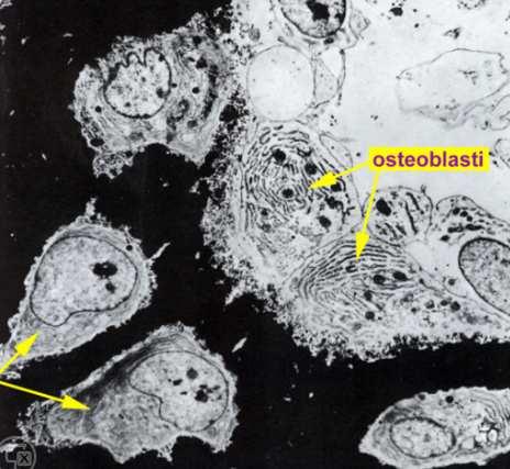 osteoblasti: fratture ELEMENTI CELLULARI CELLULE OSTEOPROGENITRICI: cellule staminali che derivano dal mesenchima Durante la crescita dell osso proliferano attivamente formando osteoblasti