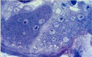 ELEMENTI CELLULARI OSTEOCLASTI: cellule plurinucleate correlate ai MACROFAGI - responsabili del riassorbimento della matrice ossea.