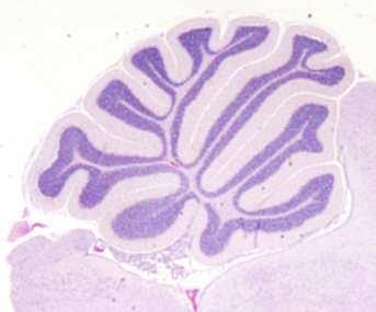 Sviluppo del cervelletto nel