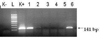 Early Detection di Aspergillus carbonarius attraverso lo studio di marker molecolari idonei Rilevamento tempestivo di A.