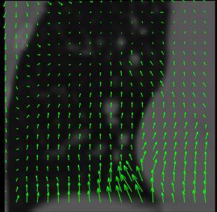 Z Testa Z X Y X Piedi Y Figura 2.15. Rappresentazione dei sistemi di riferimento rispettivamente in blu quello della CT, in rosso quello della CBCT.