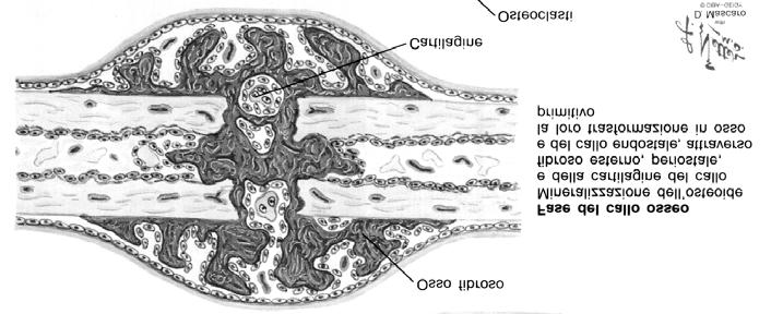 Calcificazione della cartilagine Ossificazione centripeta: prima endo e