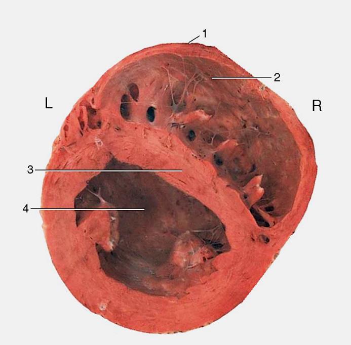 La camera del ventricolo sinistro si presenta, in sezione, di forma