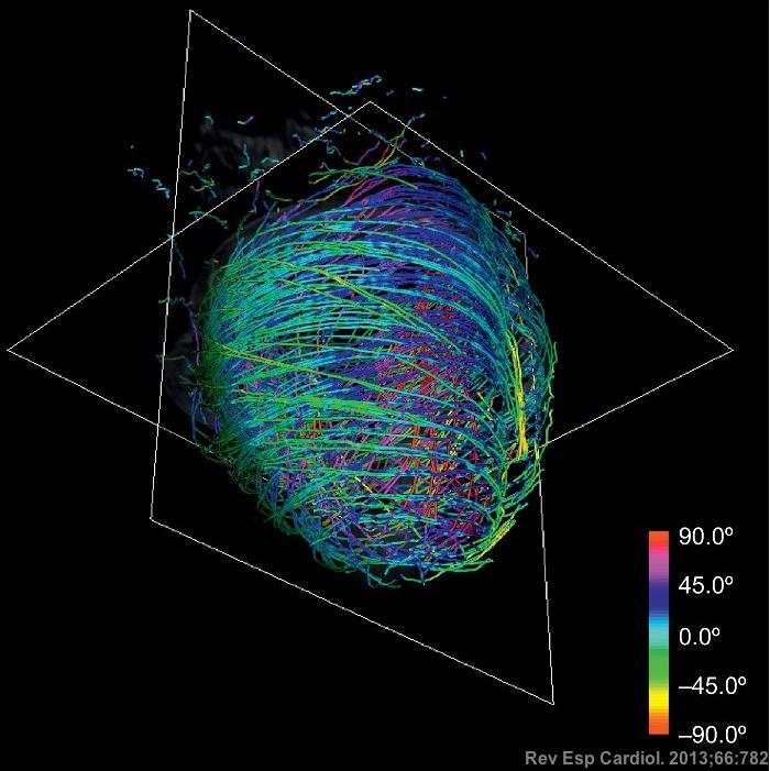 Color map of the reconstructed fibers.