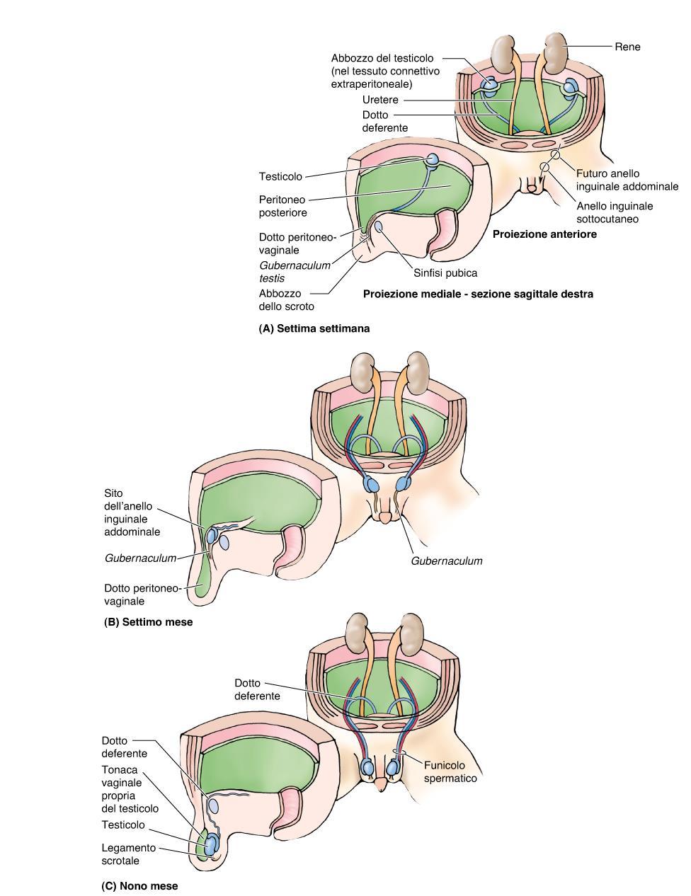 DISCESA DEL TESTICOLO DALLA PARETE