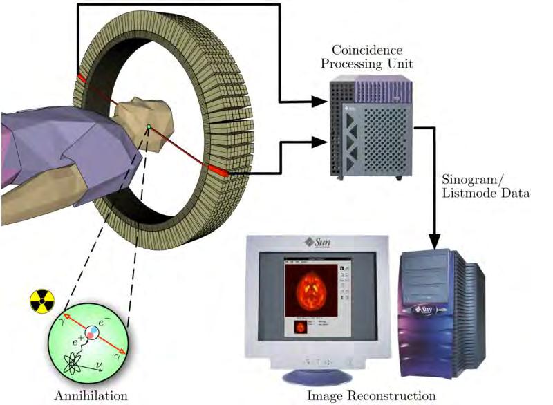 pplicazione della radiazione β + : PET La PET (Positron Emission Tomography): è una tecnica d immagine di medicina nucleare che produce immagini 3D dei processi funzionali dei organismi.