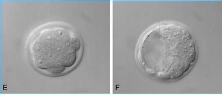 cellule B, stadio a 2 blastomeri; F, stadio di