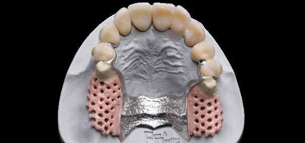 8 visio.lign 0. Completamento dello scheletrato I denti neo.