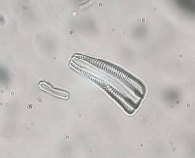 ATTIVITA PREVISTE Definizione di una lista di specie comuni in Italia; Definizione delle chiavi dicotomiche a livello di genere da utilizzare per l identificazione l degli organismi; Creazione di un