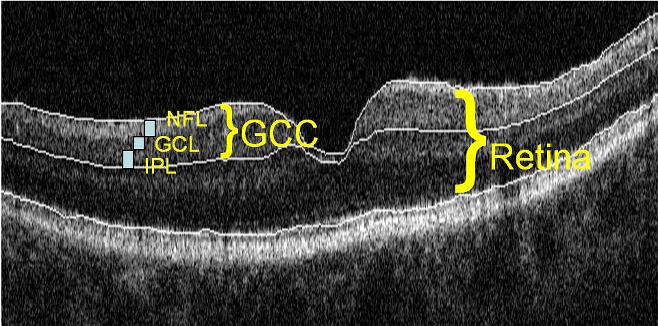 GCC Complesso delle cellule